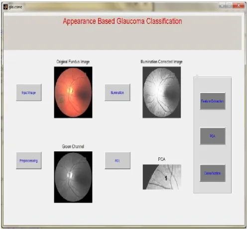 TABLE IV: Dataset for Fundus Image Classification 