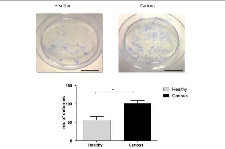 FIGURE 1 | Colony formation in hDPC and cDPC cultures. Cells were cultured for 14 days under basal conditions and stained with Toluidine blue as described in Methods