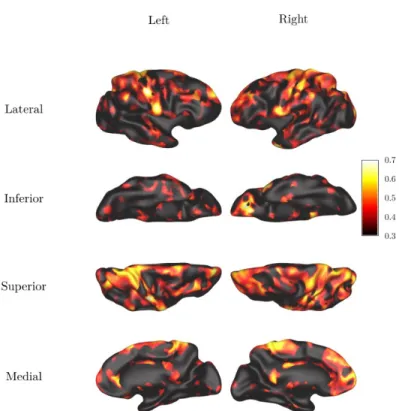 Figure 2. Heritability (h 2 ) map of cortical thickness, masked by test-retest reliability, showing only the heritable measure  with reliability ICC > 0.6