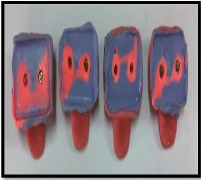 Figure 2a: Custom Impression Trays (Intaglio Surface) 