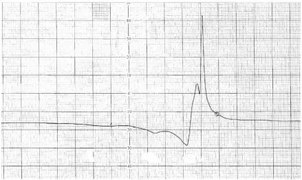 Figure 3. EPR spectrum of Copper complex 3 
