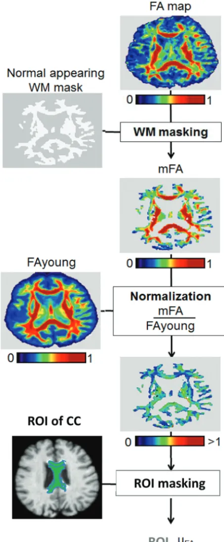 Fig 1. Flow chart of FA normalization and masking of a region of interest (� indicatesmean)