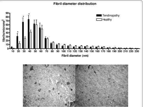 Figure 1 Fibril diameter distribution. Fibril diameter of the tendinopathic and the healthy area of the same tendon divided into fractions.Error bars represent SEM (P < 0.05).