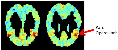 Figure 4: The mappings (D( b ) ) from latent se-mantic space (A) to brain space (Y) for fMRI andwords from three semantic categories