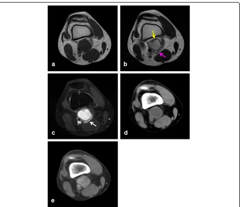 Fig. 4 A 36-year-old man diagnosed with angiomatoid fibrous histiocytoma (case 5): (a) T1-weighted spin echo, (b) T2-weighted spin echo, and (c)contrast-enhanced MR images