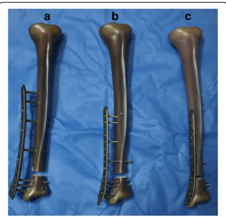Fig. 1 Examples of different models of specimen. The tibia in theexternal fixation (EF)-femur model (a) was plated on the medial aspectusing an ure titanium 5-mm 9 + 7-hole LCP (medial distal femur plate,Kanghui), with a distance of 30-mm between the surfa
