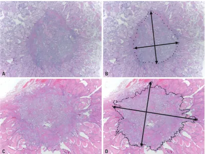 Fig. 1. Examples of measurements of tumor diameter. (A and B) Well-demarcated papillary thyroid carcinoma