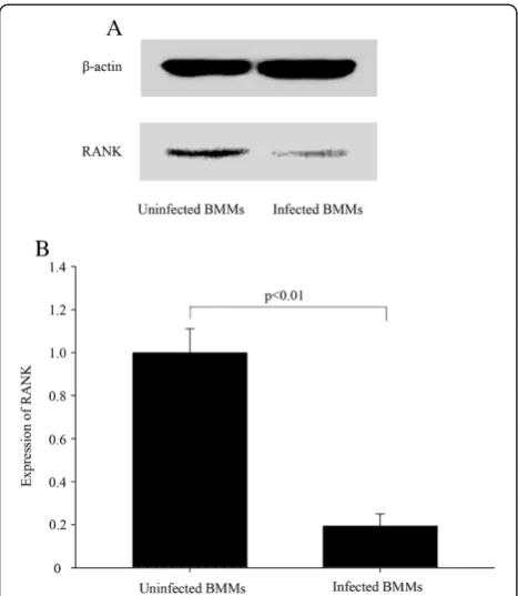 Figure 4 RANK silencing in BMMs by stable transduction byretroviruses. BMMs stably transduced with shRNA against the RANKwere analyzed for RANK protein levels by Western blot (A, B); β-actinserved as a loading control.