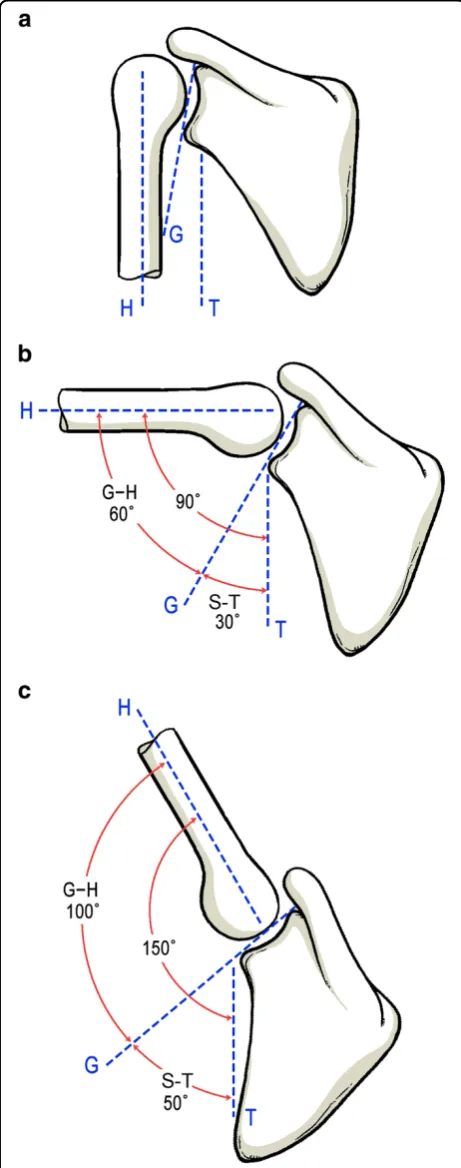 Figure 1 The schematic drawing of scapulohumeral rhythm.Resting position (A). Position of arm elevation to (B) and above(C) the horizontal