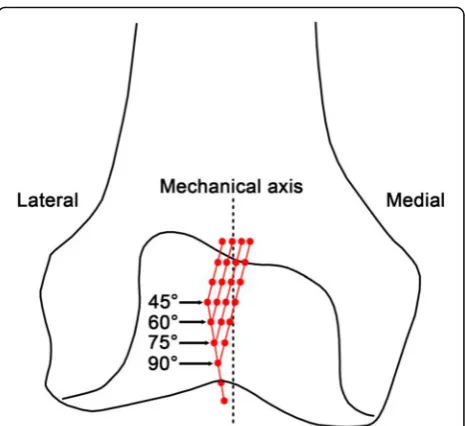Fig. 1 Methodology of classifying the trochlear groove tracking in termsof morphology
