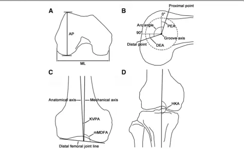 Fig. 3 Definitions of the size-, shape-, and alignment-related parameters used in the present study.mMDFA, mechanical medial distal femoral angle