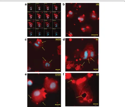 Fig. 4 a-f Confocal Microscopy. Representative images of z-stacks optical sections (a), untreated cells (b), NiCl2 (c), Ni (d), CrCl3 (e), and Cr (f) -stimulatedcells