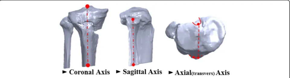 Fig. 2 Modeling is performed by acquisition of the data a selection of the ROI b and 3D reconstruction process c