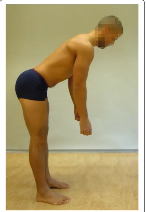 Figure 2 The Standing bow (SB) test (reproduced withpermission from Movement Performance Solutions)