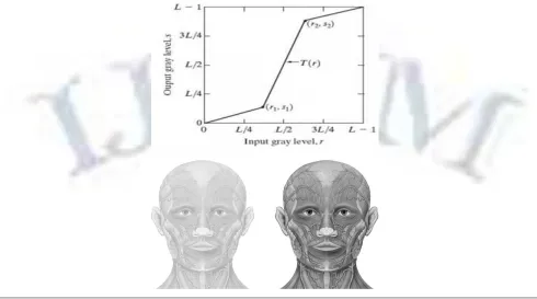 FIGURE 1: SHOWS THE RESULT OF CONTRAST STRETCHING OBTAINED USING A SIMULATION TOOL MATLAB 