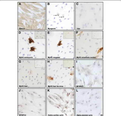 Figure 3 Immunocytochemical analysis of proliferating human mononucleated myoblasts.desmin revealed the myogenic potential of virtually all mononucleated cells