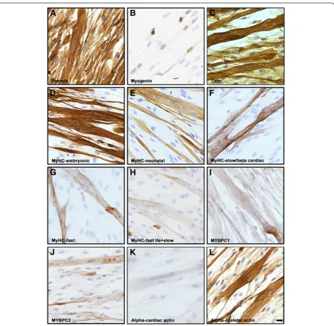 Figure 4 Immunocytochemical analysis of human cells after 6 days of differentiation.staining with the antibody against MyHC-embryonic and (was revealed in a subset of fused cells using antibodies against these isoforms
