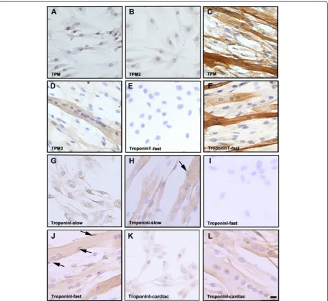 Figure 5 Immunohistochemical analysis of human myoblasts and cells after 6 days of differentiation.in (myoblasts whereas positive staining was observed in (of both (multinucleated myotubes have a myofibre-like appearance with peripherally located nuclei (p
