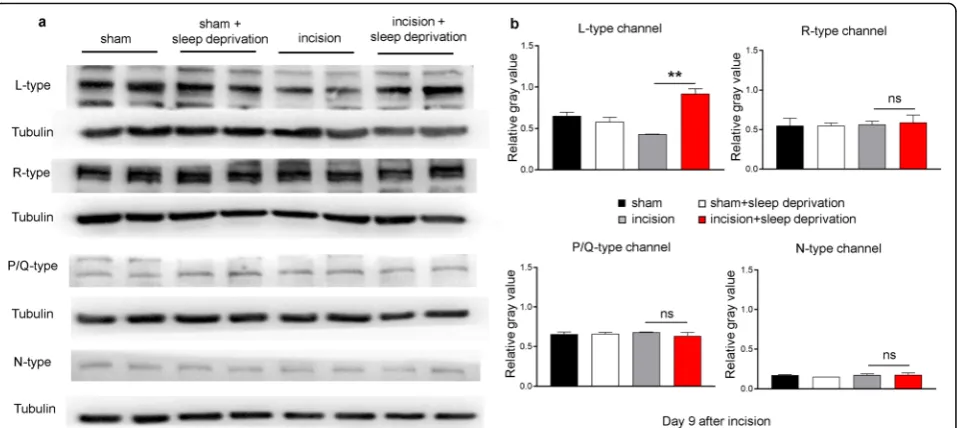 Fig. 2 Perioperative SD increases expression of L-type HVA channels in lumbar (L4R-type, P/Q-type, and N-type channel proteins in the L4results in A (10 rats per group)