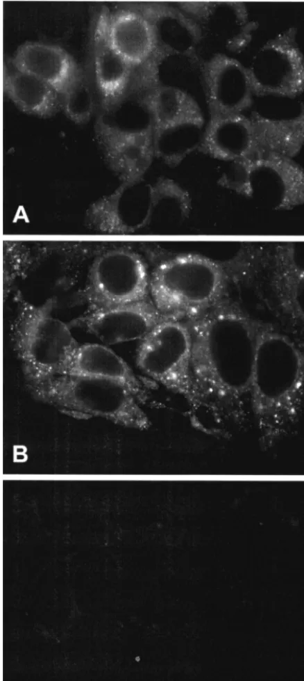 FIG. 4. NS5A-GFP can be directly visualized by ﬂuorescence mi-croscopy. Huh-7.5 cells harboring the constructs GIT/5A-GFP-6
