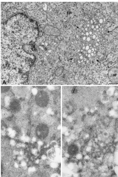 FIG. 7. Ultrastructure of GFP replicon cells and immunogold detection of GFP and HCV nonstructural proteins on the membranous web.(A) Huh-7.5 cells harboring replicon construct I/5A-GFP-1 were analyzed by EM at 5 days postseeding