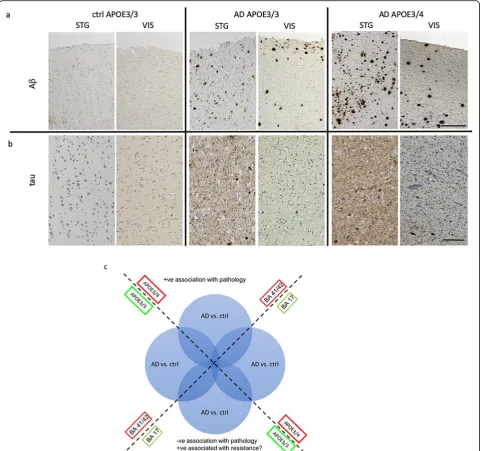 Fig. 1 Increased pathology in temporal compared to occipital cortex and incortex (BA17)