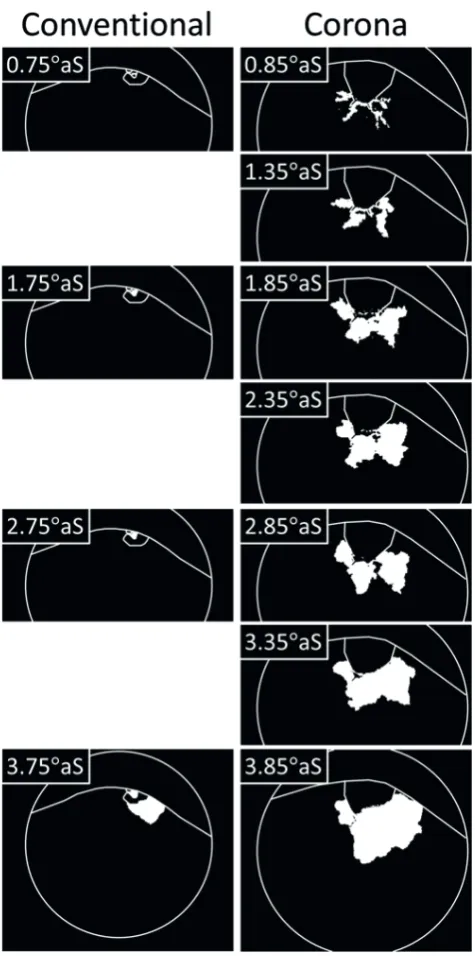 Figure 15 shows the standard deviation of the binarized images at five normalized crank angles (ϴ1/5 through ϴ5/5) for all four igniter/mixture combinations