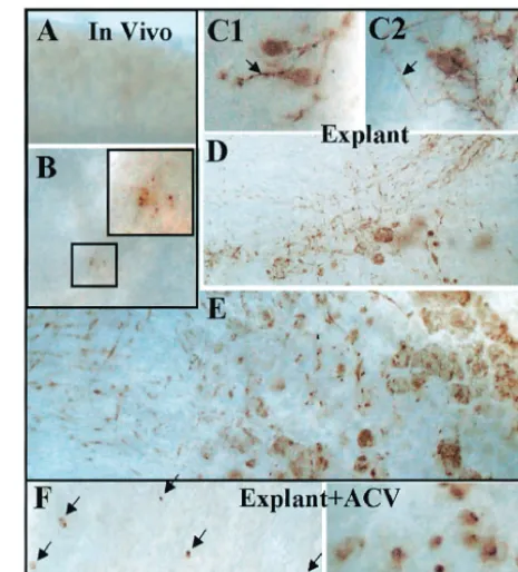 FIG. 5. Analysis of viral protein expression as a marker for reacti-vation and virus spread in vivo following hyperthermic stress and in