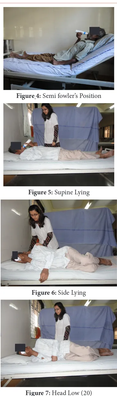 Figure 4: Semi fowler’s Position