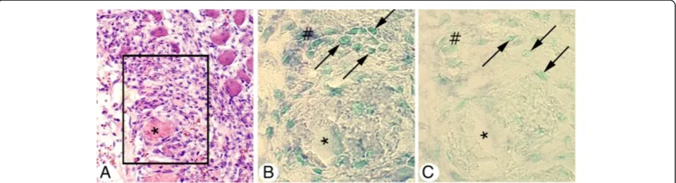 Figure 3 Expression of tachykinin mRNA in affected muscle tissue as seen via in situ hybridization