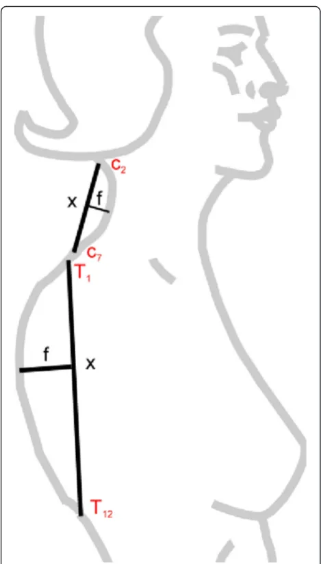 Fig. 5 Model for the measurement of spinal curvatures using thecurvature index: IC = (f/x) x 100
