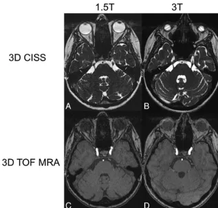 Fig 1. Axial source images of 3D-CISS sequences at the level of the trigeminal nerve root (A and B) and 3D-TOF MRAs at the level of the cavernous sinus (C and D) at 1.5T (A and C)and 3T (B and D) in the same patient