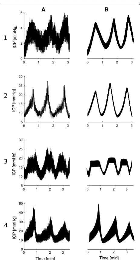 Fig. 3 Presentation of different B waves sub‑classification patterns. Each is illustrated by two computer‑generated examples: column A simulating ICP recordings and column B showing an artistic rendering