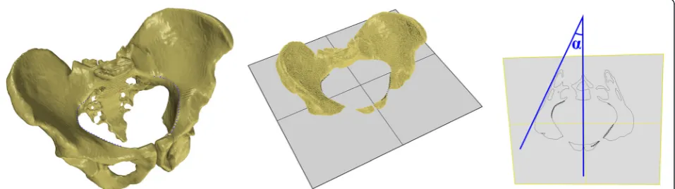 Fig. 1 a Sacrum Base (SB) plane with corresponding saggital plane and the coordinate system XYZ, b The acetabulum axis set on the 3D model