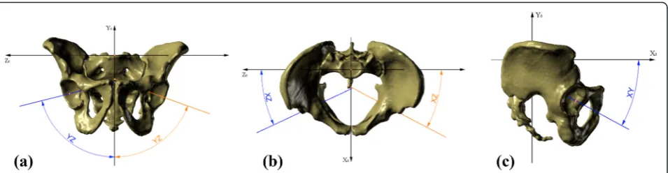 Fig. 5 Angles of three-dimensional orientation of the acetabulum. a Inclination angle, b anteversion angle, and c tilt angle