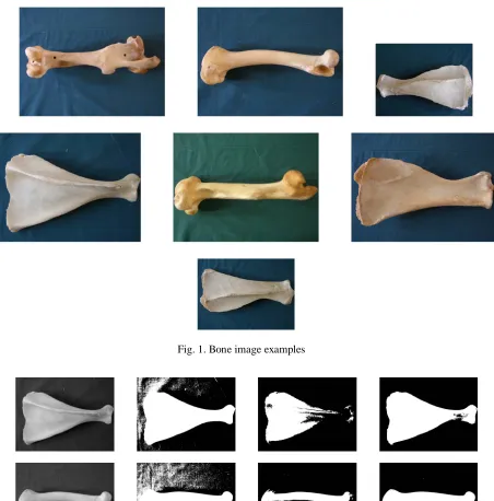 Fig. 1. Bone image examples 