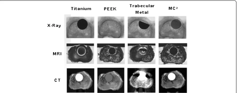 Figure 2 Silicon nitride, titanium, PEEK and trabecular metal imaging characteristics in a human cadaveric vertebra (unpublished data).