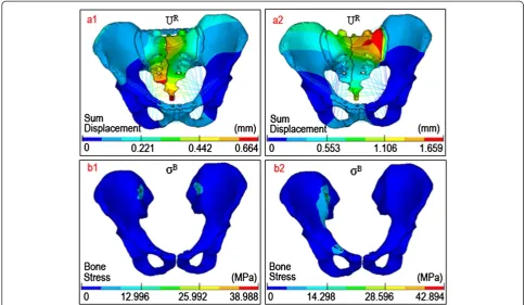 Figure 6 The distribution nephogram of displacements/stresses. The representative distributions of (a) the sum displacements and (b) vonMises stresses in two surgical FE models with Denis III type fractures (PTMP vs