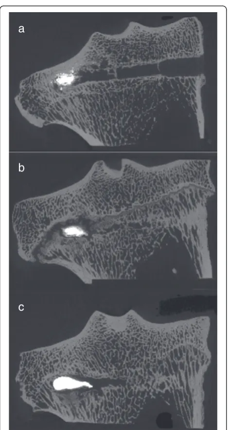Figure 7 Microradiograph image. This figure shows amicroradiograph image of a ground section: Stage of bonecalcification in the area of interest and adjacent to remainingbiomaterial could be shown.