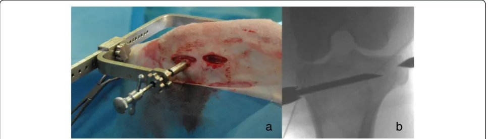 Figure 2 Correct placement of the aiming device. The aiming device was placed with the tube for the needle at the medial aspect and thesharp tip fixed on the lateral aspect of the tibia (a)