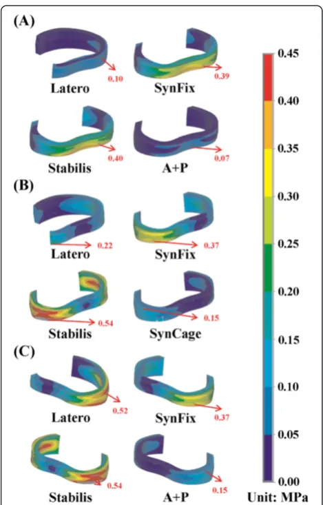 Figure 5 Stress distribution of the ground substance at thesurgical level for all models