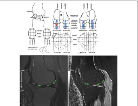 Fig. 1 Modified standard drawing published by the International Cartilage Repair Society (ICRS) for mapping a cartilage lesion