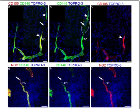 Fig. 6 Representative confocal microscopy images of pericyte TNT involved in vessel growth and sprouting in the developing human by a  CD146colocalized with CD146 on a leading pericyte (PC) and on its short TNT (arrow)