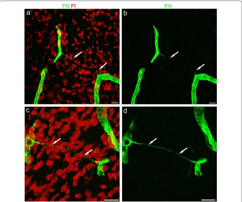 Fig. 1 Representative confocal microscopy images of TNTs in the developing human telencephalon at 18 wg