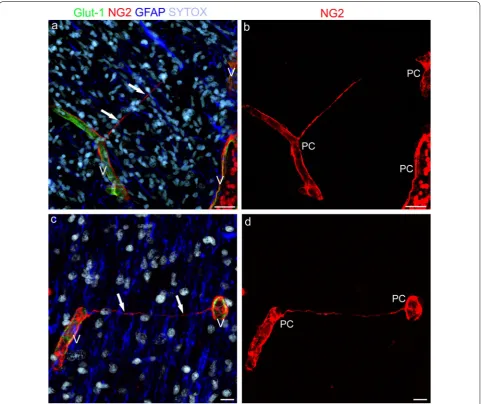 Fig. 2 Representative confocal microscopy images of blood–brain barrier (BBB)-microvessels and TNTs in the developing human telencephalon at details of their  NG222 wg