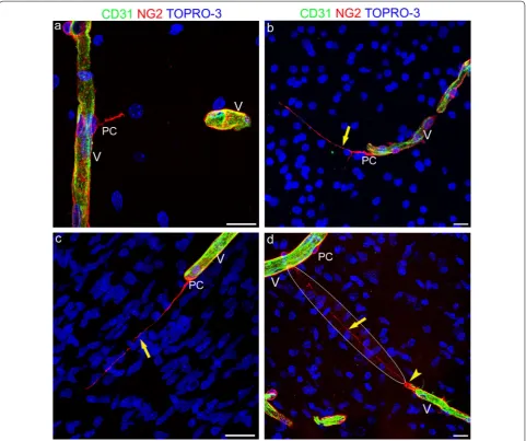 Fig. 3 Representative confocal microscopy images of pericyte TNTs in the developing human telencephalon at 22 wg