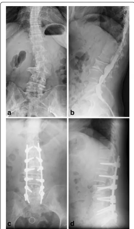 Fig. 4 A 55 year old female patient with back pain and left legnumb pain for four months