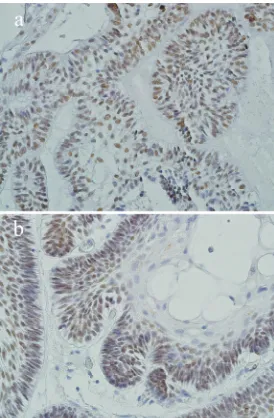 Figure 2a: P63 expression in ameloblastoma (tion). ×400 magnifica-b: Squamous metaplasia does not show P63 expression