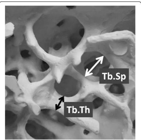 Fig. 2 Trabecular microstructural parameters (reprinted from theliterature with permission) [18]