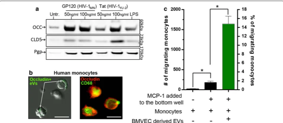 Fig. 3 BMEC EVs and their effect on immune cell migration in the context of HIV. increased transendothelial migration when exposed to BMEC derived EVs
